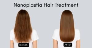 What Is Nanoplastia Hair Treatment? Everything You Need to Know!